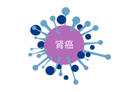 肺癌Renal carcinoma